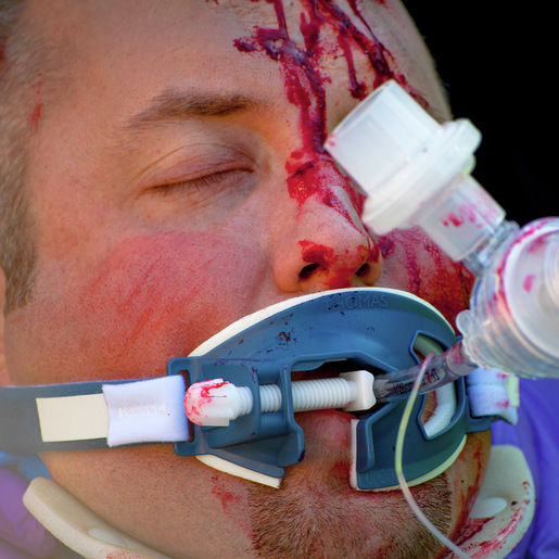 Thomas ET Tube Holders