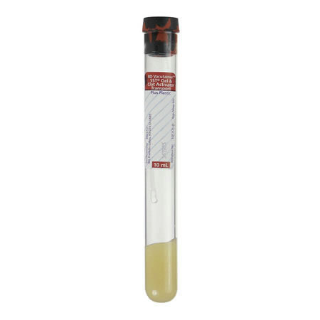 Red/Gray Top Blood Collection Tubes