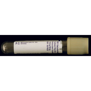 Gray Top Blood Collection Tubes