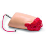 Amputated Leg for SimMan® ALS