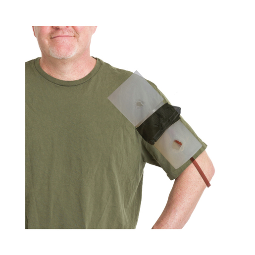 Wound Club™ with Blood Pump