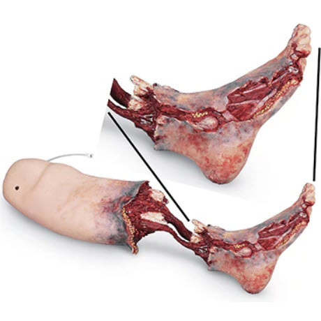 Smart Stat Xtreme Trauma Bleeding Leg, Light Skin