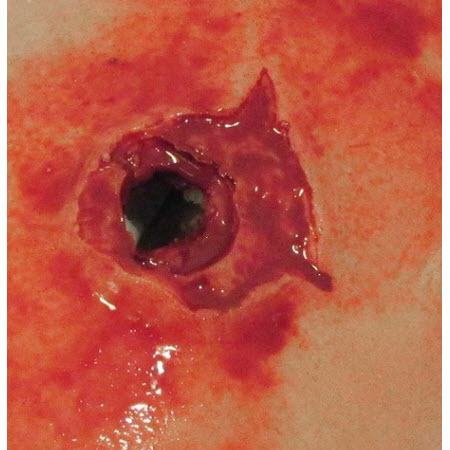 TrueClot® Wound Packing Task Trainer, Large Caliber Gun Shot Wound