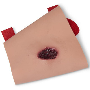 Impalement of Lower Leg