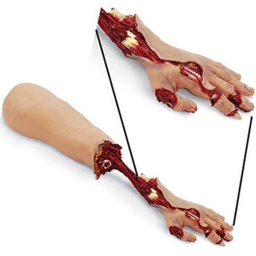 SMART STAT Xtreme Trauma Bleeding Arm