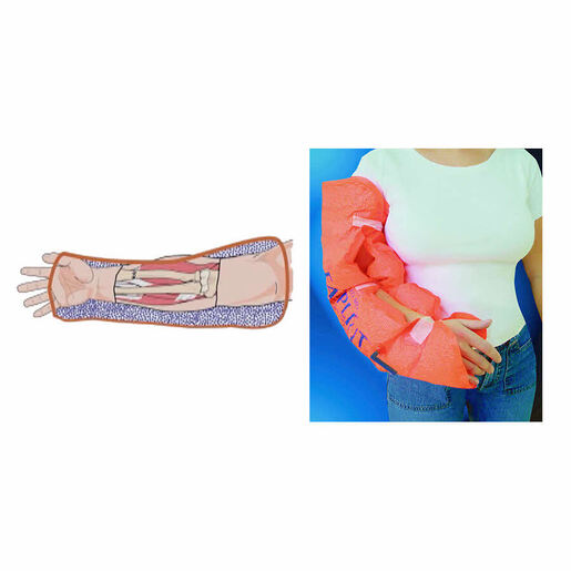 FASPLINT®  Vacuum Splint Kits