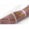 Standard Venipuncture Arms