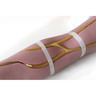 Standard Venipuncture Arms