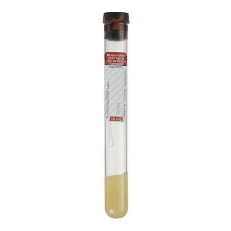 Red/Gray Top Blood Collection Tubes